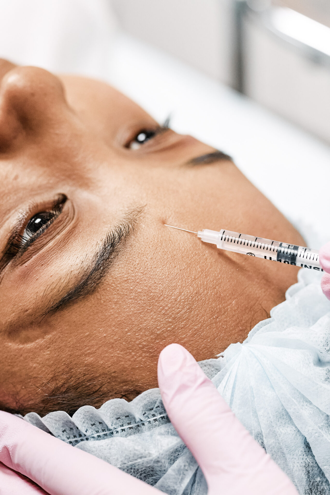 A professional is adding botox to a woman's forehead. This article covers the topic of Botox vs Fillers, what do you need?