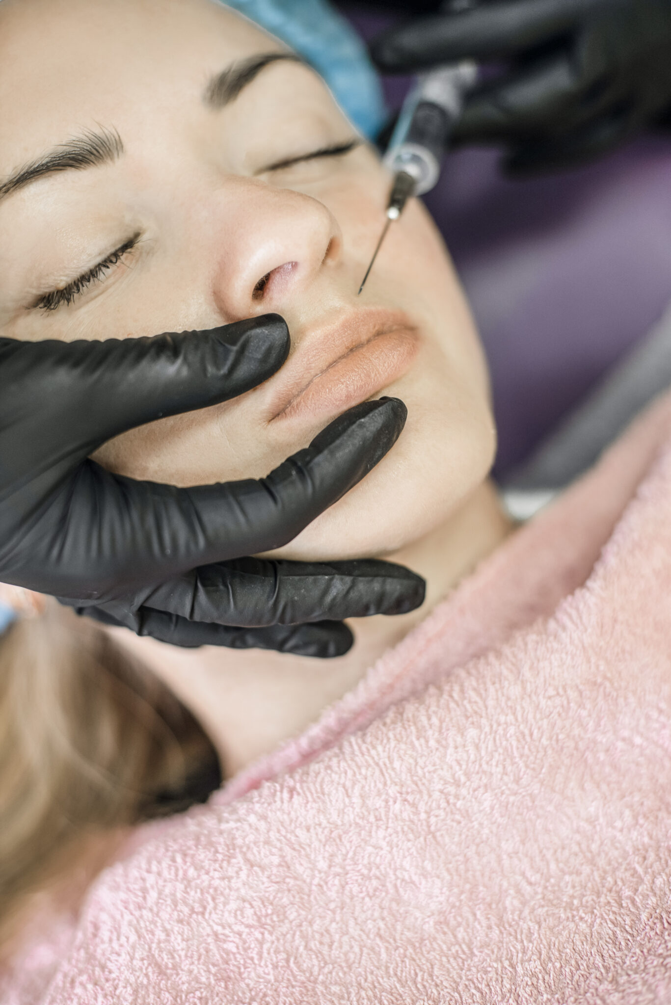 A professional adds dermal fillers to a woman's lips.