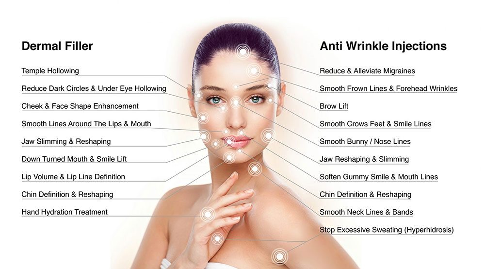 A diagram shows botox and filler locations on face and body.