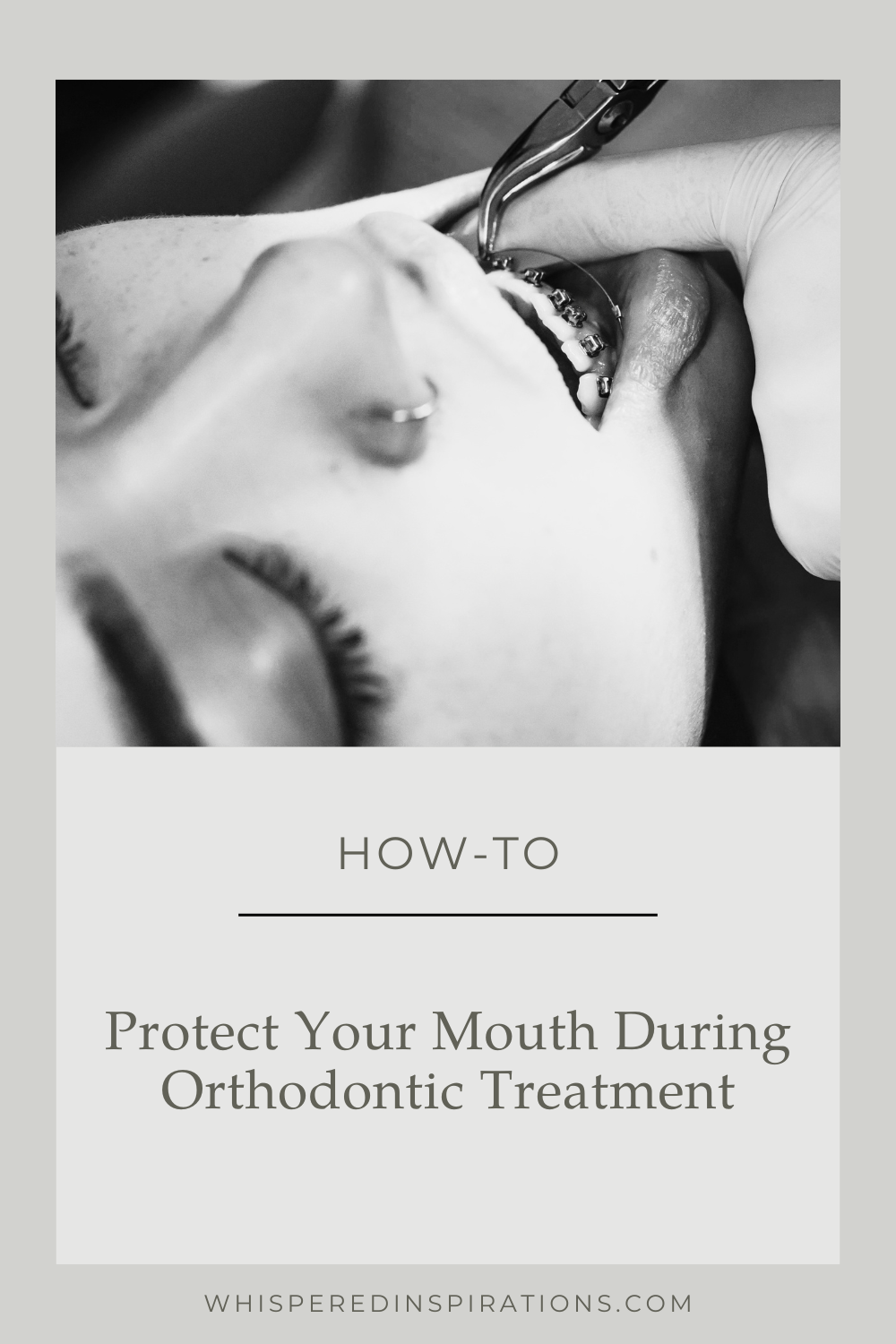 Discover essential habits for protecting your mouth during orthodontic treatment. Keep your teeth and gums healthy today.